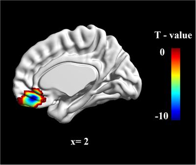 Do Future Limitation Perspective in Cancer Patients Predict Fear of Cancer Recurrence, Mental Distress, and the Ventromedial Prefrontal Cortex Activity?